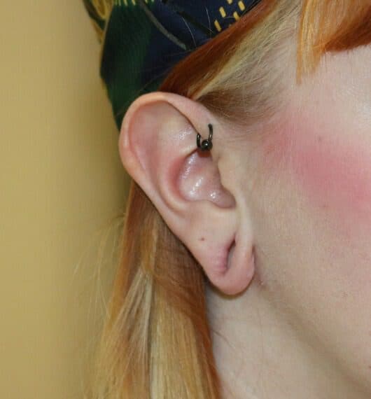 Earlobe Repair