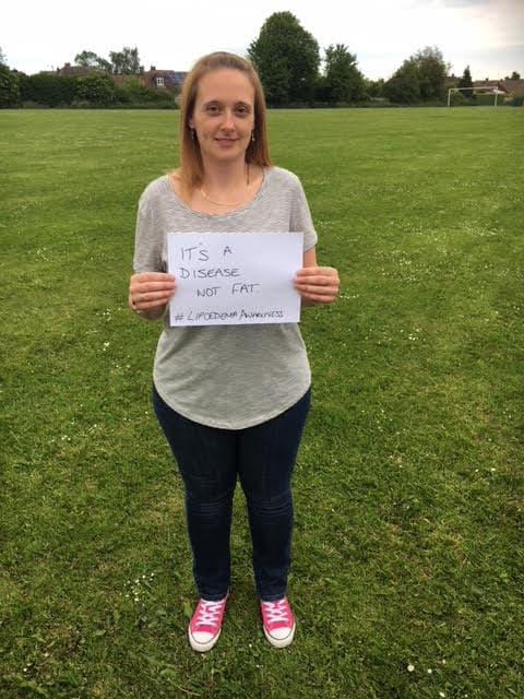 Life with Lipoedema - Fiona Cowles Story...