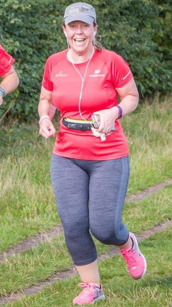 Living with Lipoedema- Beth W-B, Life After Surgery...