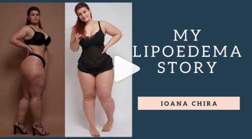 Instagram Fitness Star Ioana Chira (Ioana_Fit) on Living with Lipoedema