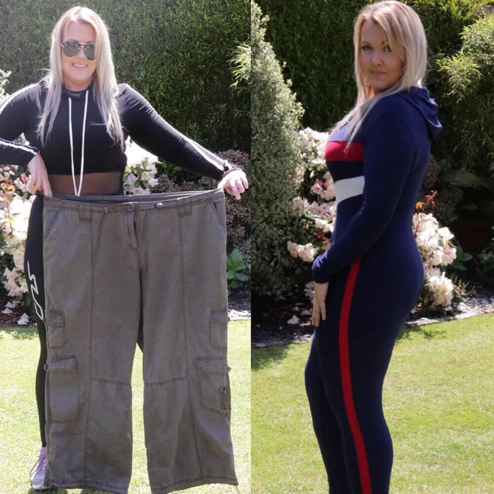 Living with Lipoedema - Karen Windsor's Story...