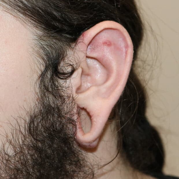 Tribal / Earplug Repair
