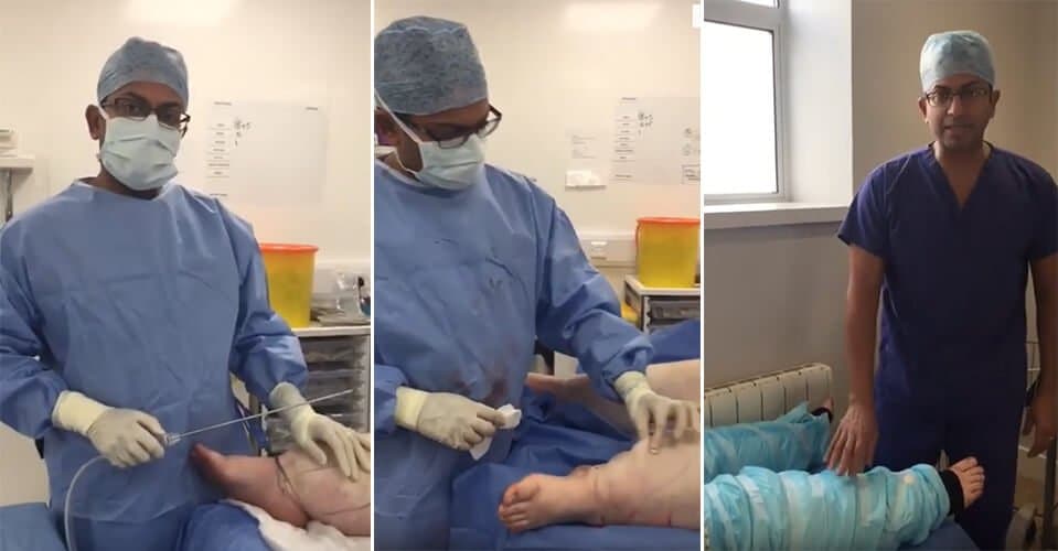 WATCH: Pre Op, Post Op and Recovery - Body-jet Water Assisted Liposuction for Lipoedema