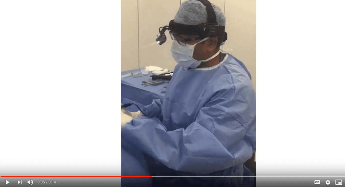 Facelift Surgery - Creating an Inconspicuous Scar and Sedation Anaesthesia